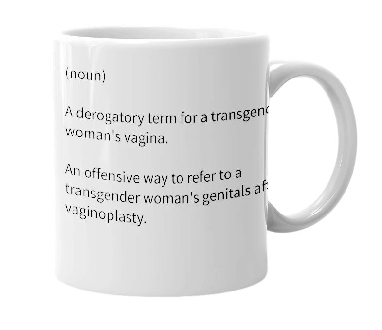 White mug with the definition of 'Poopwound'