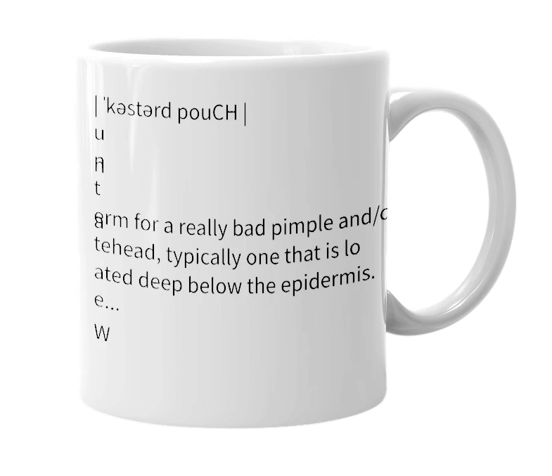 White mug with the definition of 'Custard Pouch'