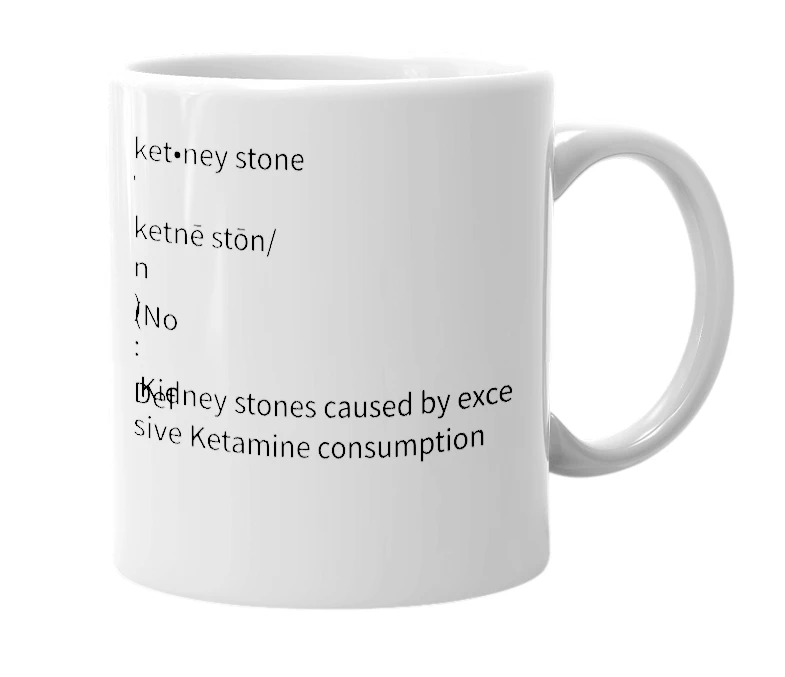 White mug with the definition of 'Ketney stone'