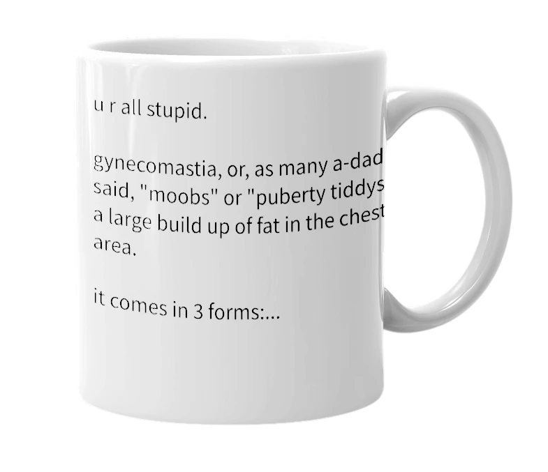 White mug with the definition of 'gynecomastia'