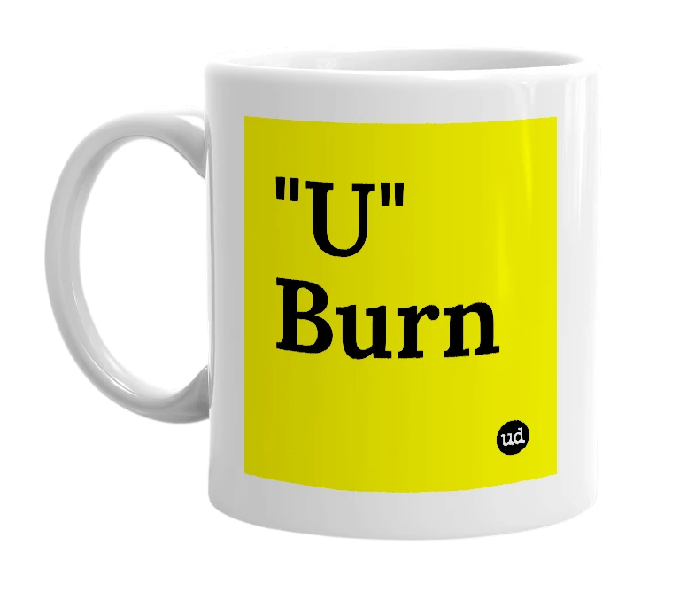 White mug with '"U" Burn' in bold black letters
