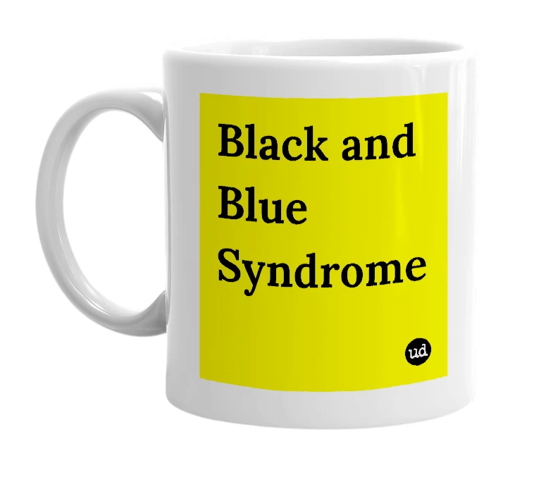 White mug with 'Black and Blue Syndrome' in bold black letters