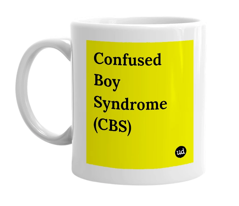 White mug with 'Confused Boy Syndrome (CBS)' in bold black letters