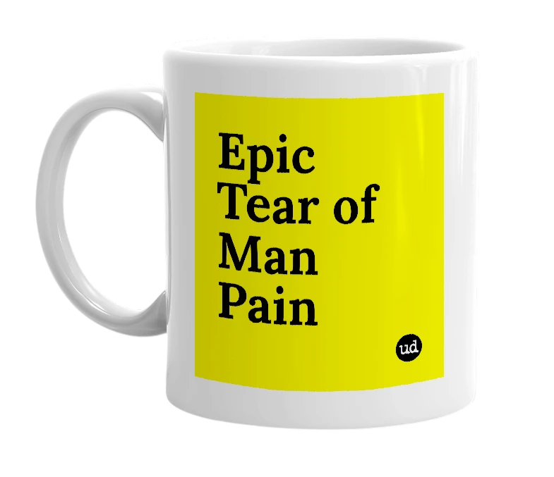 White mug with 'Epic Tear of Man Pain' in bold black letters