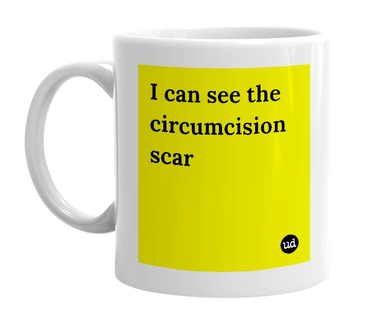 White mug with 'I can see the circumcision scar' in bold black letters