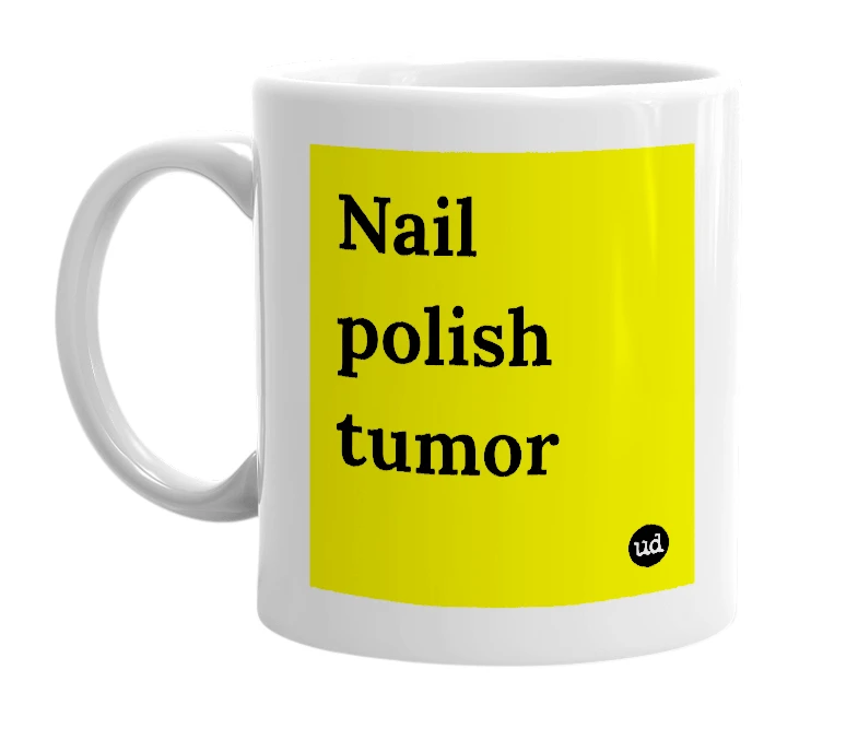 White mug with 'Nail polish tumor' in bold black letters