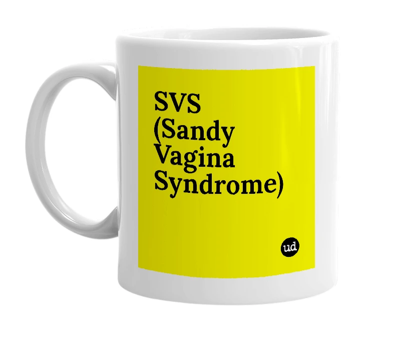 White mug with 'SVS (Sandy Vagina Syndrome)' in bold black letters