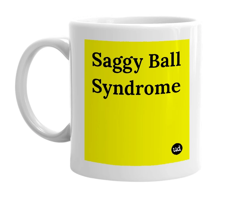 White mug with 'Saggy Ball Syndrome' in bold black letters