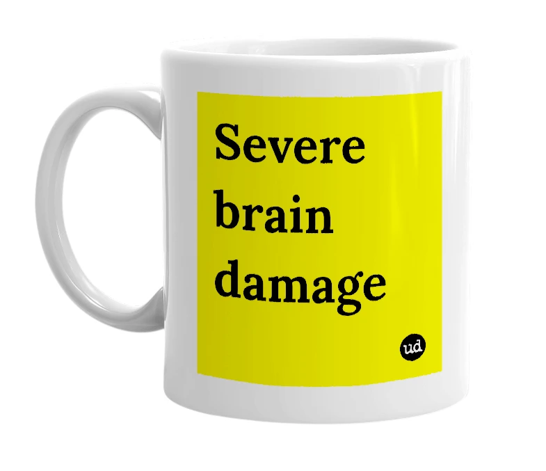 White mug with 'Severe brain damage' in bold black letters