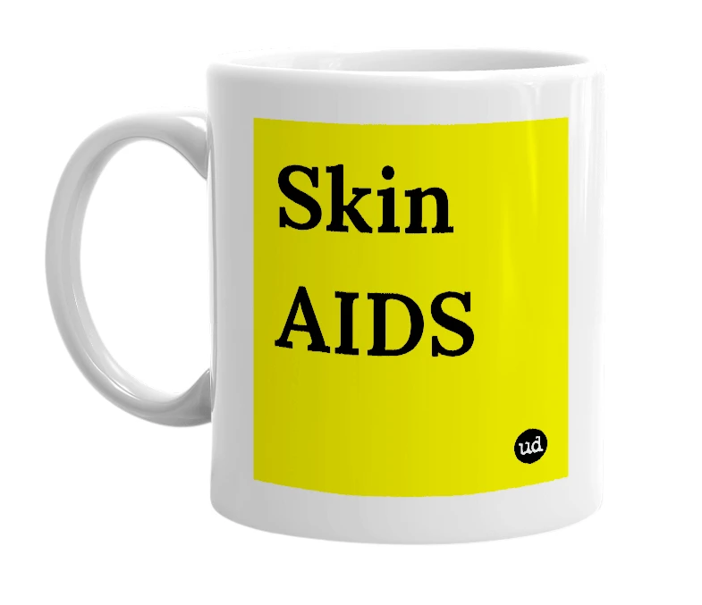 White mug with 'Skin AIDS' in bold black letters