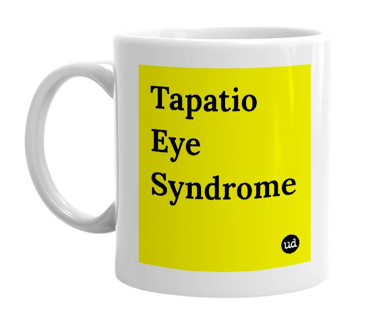 White mug with 'Tapatio Eye Syndrome' in bold black letters