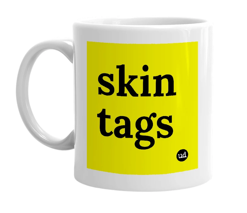 White mug with 'skin tags' in bold black letters