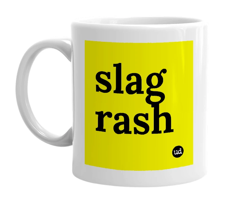 White mug with 'slag rash' in bold black letters
